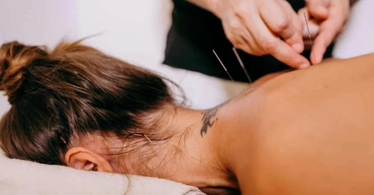 דיקור סיני לגיל המעבר: פתרון יעיל לנשים ולגברים