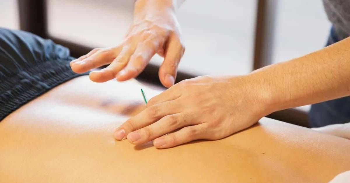 דיקור סיני לחרדות – טיפול טבעי ומוכח לחרדה וסטרס